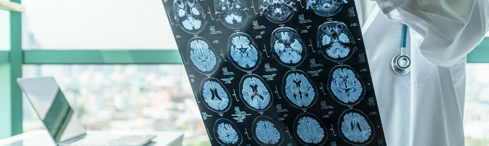 The new issue (No. 22) of Healthcare Observer, February 2, 2023, is available.<br />
<br />
In the feature article, you will learn more about the major breakthrough in Alzheimer‘s treatment.